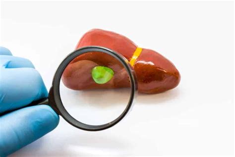 Ano Ang Gallbladder Polyp, At Ano Ang Pinagkaiba Nito Sa .